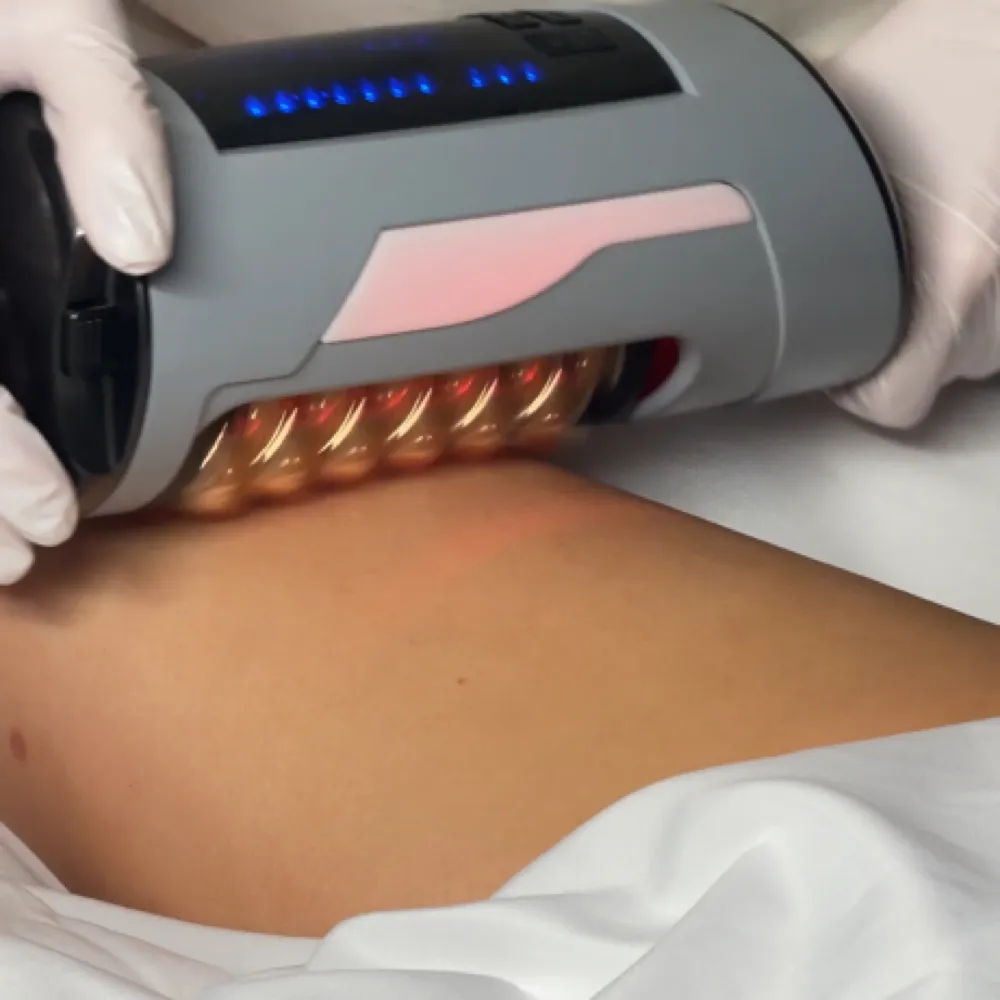The Endosphere roller handpiece worked along the arm