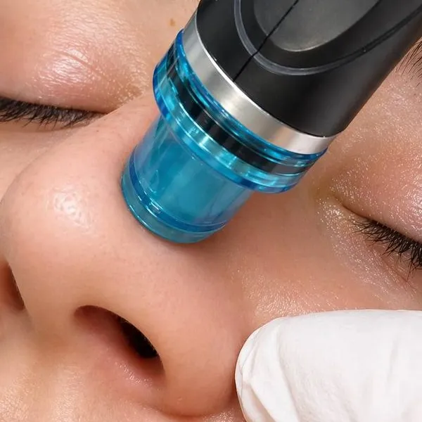 A hydradermabrasion handpiece with a blue glass tip drawn across the nose and cheek