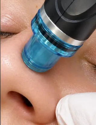 Hydradermabrasion facial treatment at La Vilna