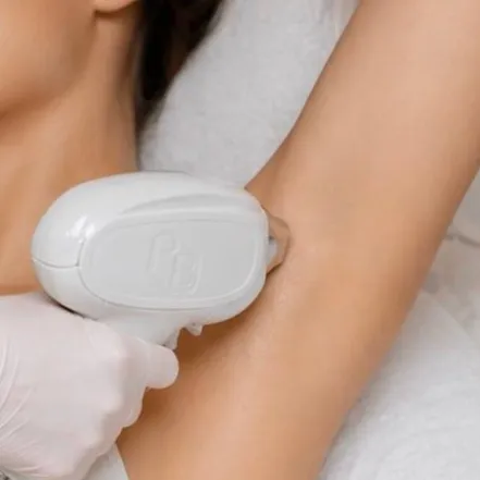 Laser hair removal handpiece applied to a raised underarm